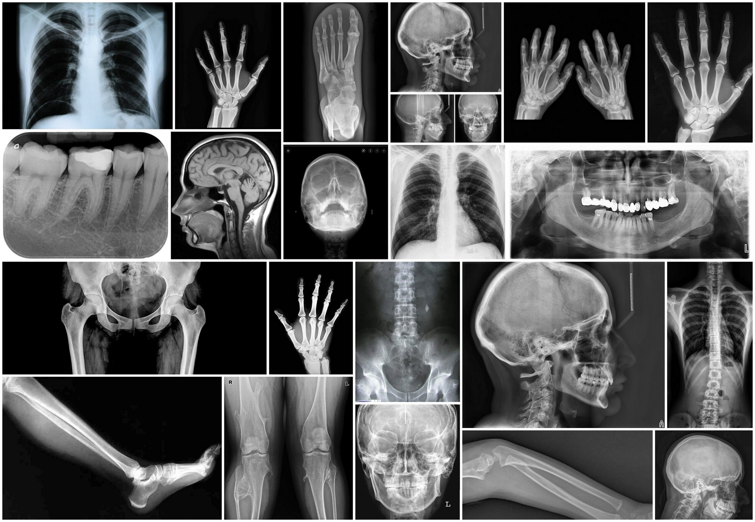 Free Printable X Rays